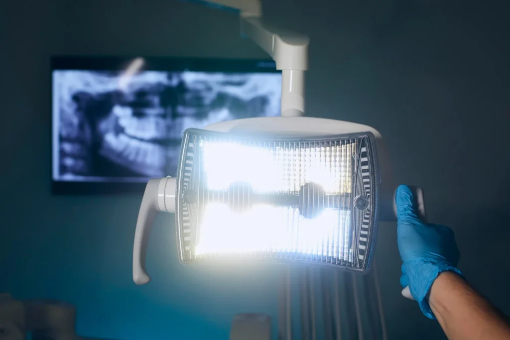 Traitement d'endodontie et dévitalisation racine de haute précision au Cabinet Almé.