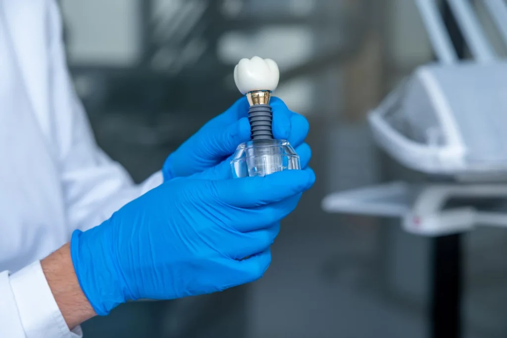 Pose implant dentaire cabinet Almé Éguilles Les Milles